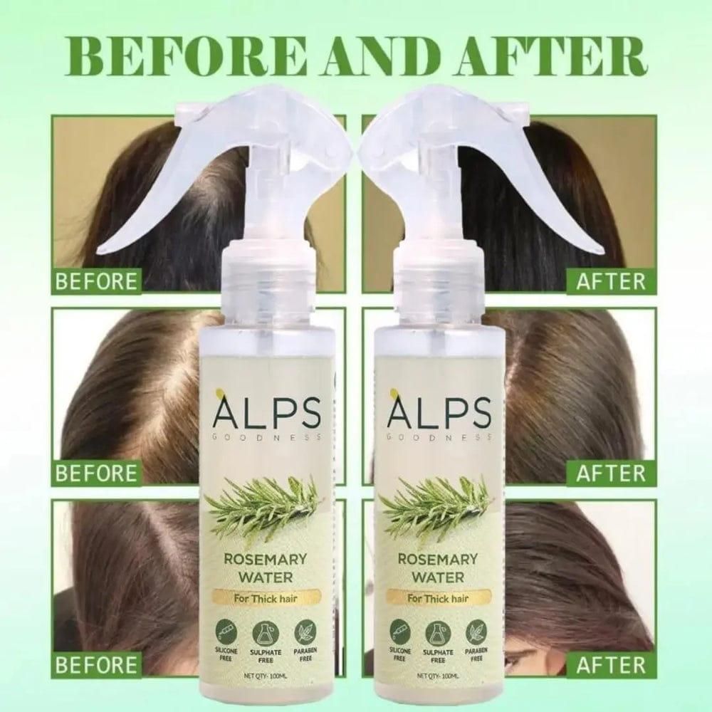 Rosemary Water Hair Spray for Regrowth (Buy 1 Get 2 Free)