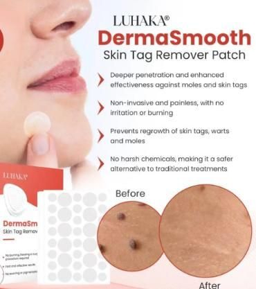 Skin Tag Remover Patch for Safe Skin Tag Treatment